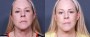Dr. Roark Facelift Patient 7