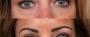 Dr. Saltz Eyelid Lift Patient 1