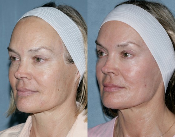 579781RepairPortrait2