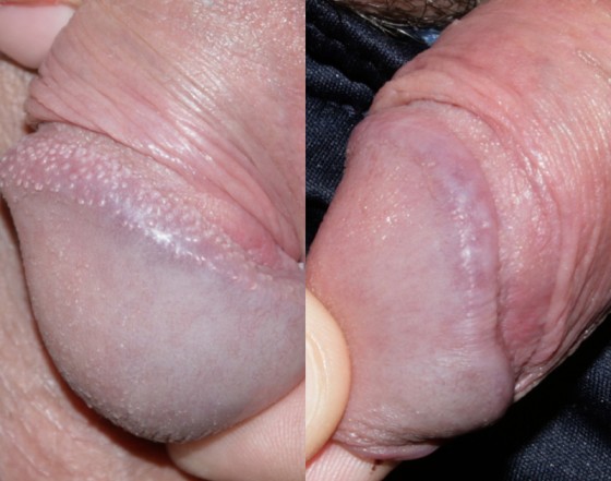 580235PPP1-2