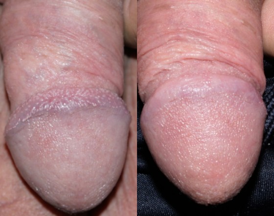 580235PPP1