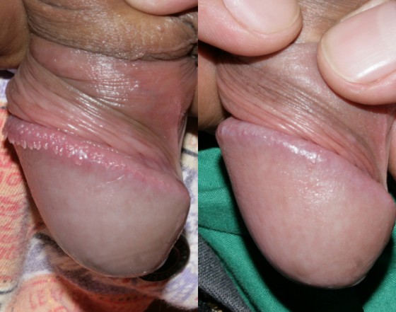 584844PPP1-2