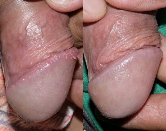 584844PPP1