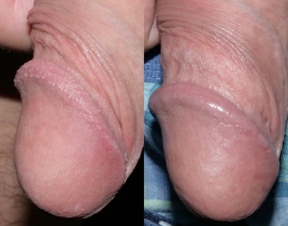 584952PPP1-2
