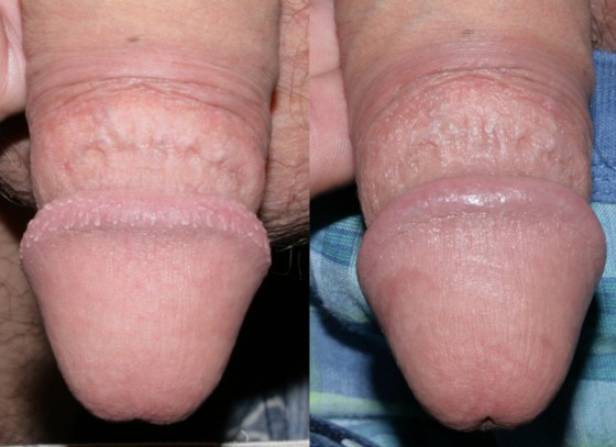 584952PPP1