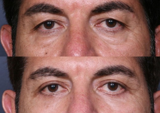 585509JLGEyes2