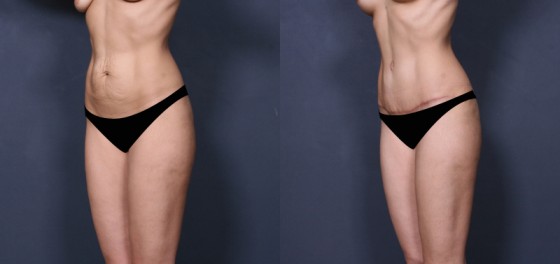 58605302