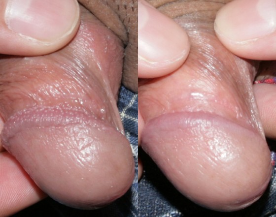 586405ppp2