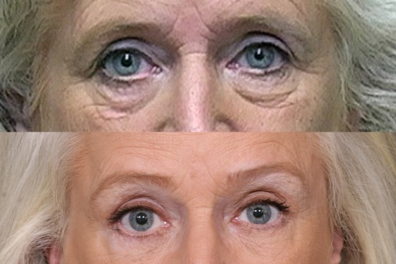Eyes556442001