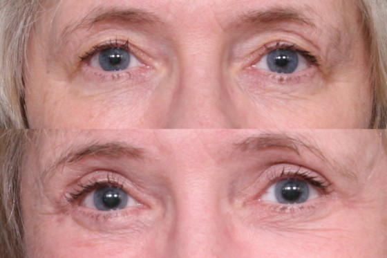 Face06Eyes001