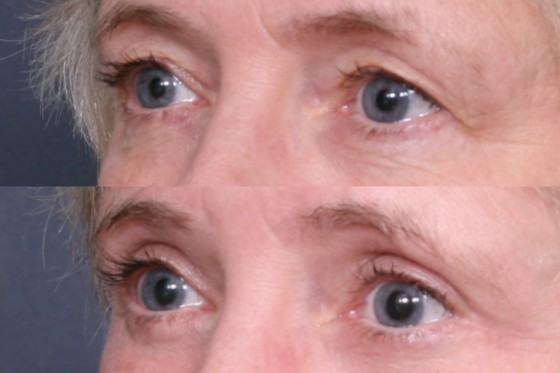 Face06Eyes002